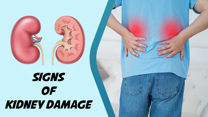 Signs of Kidney Damage